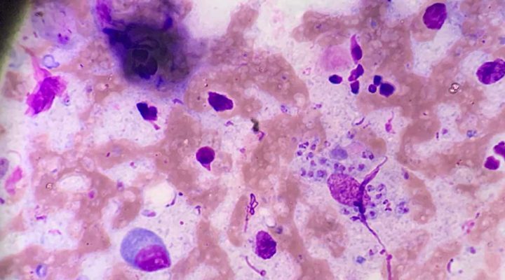Desarrollan estrategia molecular para mejorar el diagnóstico de las leishmaniasis