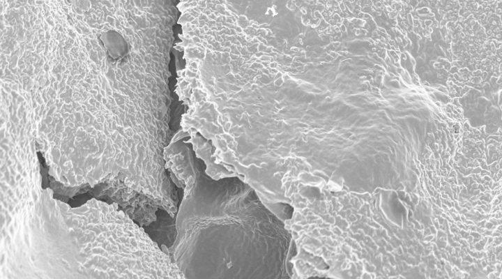 Investigadores del CONICET trabajan en la optimización de un tratamiento contra el glaucoma