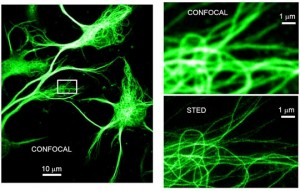 Comparacion de una imagen confocal con una de super-resolucion mediante STED.